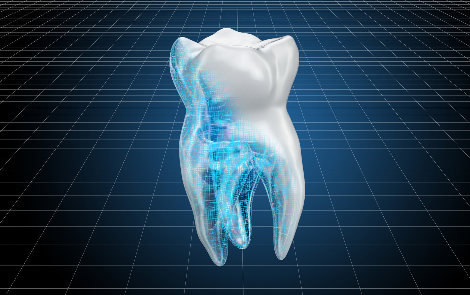 Cad image of a tooth